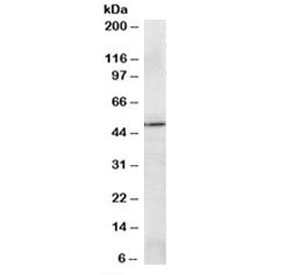 Western blot testing of A549 lysate with PRDM11 antibody at 2ug/ml. Predicted molecular weight: ~58/54kDa (isoforms 1/2).~