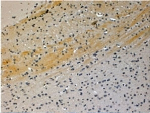 IHC testing of FFPE mouse brain with JIP3 antibody at 4ug/ml. HIER: steamed with pH6 citrate buffer, HRP-staining.~