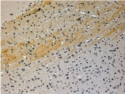 IHC testing of FFPE mouse brain with JIP3 antibody at 4ug/ml. HIER: steamed with pH6 citrate buffer, HRP-staining.