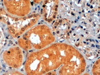 IHC staining of FFPE human kidney with S6K antibody at 2ug/ml. HIER: steamed with pH6 citrate buffer, HRP-staining.