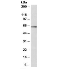 Western blot of rat brain lysate with S6K antibody at 1ug/ml. Predicted molecular weight: ~59kDa, routinely observed at 59-70kDa.