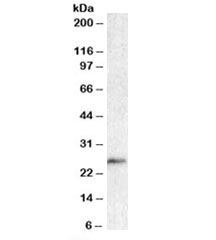 Western blot testing of human lymph node lysate with BCL7A antibody at 1ug/ml. Predicted molecular weight: ~25kDa.