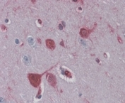 IHC staining of FFPE human brain cortex with RAE1 antibody at 4ug/ml. HIER: steamed with pH6 citrate buffer, AP-staining.
