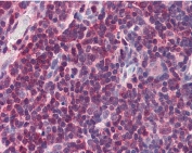 IHC testing of FFPE human thymus tissue with MIF antibody at 5ug/ml. Required HIER: steamed antigen retrieval with pH6 citrate buffer; AP-staining.
