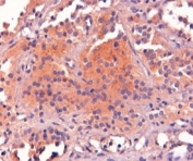 IHC staining of FFPE human pituitary gland with POMC antibody at 2ug/ml. HIER: steamed with pH9 Tris/EDTA buffer, HRP-staining.