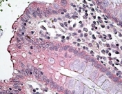 IHC testing of FFPE human colon with SLC12A2 antibody at 4ug/ml. HIER: steamed with pH6 citrate buffer, AP-staining.