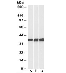 Western blot testing of human [A], mouse [B] and rat [C] heart lysates with Lactate Dehydrogenase B antibody at 0.1ug/ml. Predicted molecular weight: ~36kDa.~