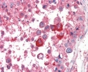 IHC staining of FFPE human testis with EIF3M antibody at 5ug/ml. HIER: steamed with pH6 citrate buffer, AP-staining.