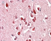 IHC staining of FFPE human cerebral cortex with UNC5C antibody at 4ug/ml. HIER: steamed with pH6 citrate buffer, AP-staining.