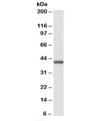 Western blot of peripheral blood lymphocyte lysate with GNAQ antibody at 0.1ug/ml. Predicted molecular weight ~42kDa.