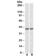 Western blot of pig colon (A) and pig spleen (B) lysates with GNAQ antibody at 0.1ug/ml. Predicted molecular weight ~42kDa.