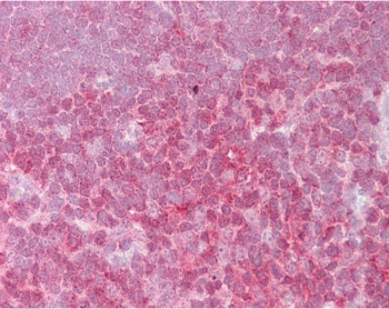 IHC testing of FFPE human thymus tissue with REL antibody at 2.5ug/ml. Required HIER: steamed antigen retrieval with pH6 ci