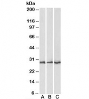 Western blot testing of mouse [A], rat [B] and pig [C] heart lysates with CAPZB antibody at 0.1ug/ml. Predicted molecular weight: ~30kDa.