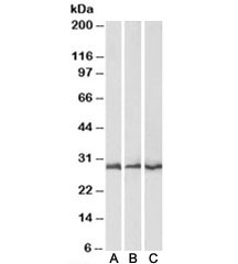 Western blot testing of mouse [A], rat [B] and pig [C] heart lysates with CAPZB antibody at