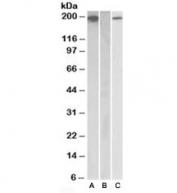 Western blot testing of HEK293 lysate overexpressing human CSF1R with MYC tag with CSF1R antibody [1ug/ml] in Lane A and probed with anti-MYC tag [1/1000] in lane C. Mock-transfected HEK293 probed with CSF1R antibody [1ug/ml] in Lane B.