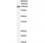 Western blot testing of human ThP-1 cell lysate with CSF1R antibody.