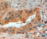IHC testing of FFPE human prostate with Semaphorin 3E antibody at 4ug/ml. HIER: steamed with pH6 citrate buffer, HRP-staining.