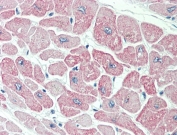 IHC testing of FFPE human heart tissue with CLIC4 antibody at 5ug/ml. Steamed antigen retrieval with citrate buffer pH 6, AP-staining.