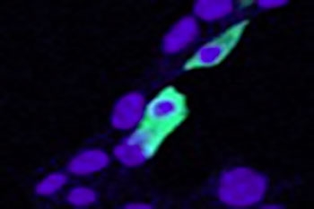 Immunofluorescence staining of min6 cells transiently expressing mouse Clic4 with CLIC4 antibody at 5ug/ml. Nuclear counter staining by Hoechst.