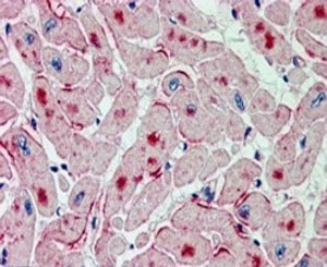 IHC staining of FFPE human heart with ATGL antibody at 2.5ug/ml. HIER: steamed with pH6 citrate buffer, AP-staining. Stain