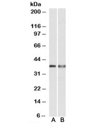 Western blot testing of U937 [A] and human spleen [B] lysates with CAPG antibody at 0.3ug/ml. Predicted molecular weight: ~38kDa.~