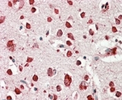 IHC staining of FFPE human cerebral cortex with SCARB2 antibody at 4ug/ml. HIER: steamed with pH6 citrate buffer, AP-staining.