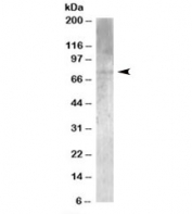 Western blot testing of human brain lysate with MPP5 antibody at 1ug/ml. Predicted molecular weight: ~77kDa.