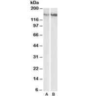 Western blot testing of gastrointestinal cancer [A] and gall bladder cancer [B] lysates with CD29 antibody at 0.5ug/ml. Predicted molecular weight: 88/130~150 kDa (unmodified/glycosylated).