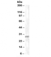 Western blot testing of K562 lysate with CHMP5 antibody at 1ug/ml. Predicted molecular weight: ~25kDa.