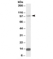 Western blot testing of NIH3T3 lysate with TRIM71 antibody at 0.5ug/ml. Predicted molecular weight: ~93kDa. Both observed bands are blocked by addition of the immunizing peptide.