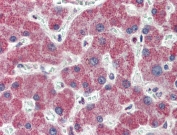 IHC testing of FFPE human liver tissue with IRAK4 antibody at 3.75ug/ml. Steamed antigen retrieval with citrate buffer pH 6, AP-staining.