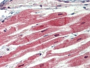 IHC testing of FFPE human heart tissue with IRAK4 antibody at 3.75ug/ml. Steamed antigen retrieval with citrate buffer pH 6, AP-staining.