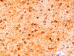 IHC staining of FFPE mouse brain with IBA1 antibody at 2ug/ml. HIER: steamed with pH6 citrate buffer, HRP-staining.