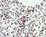 IHC staining of FFPE human spleen with EDF1 antibody at 5ug/ml. HIER: steamed with pH6 citrate buffer, AP-staining.