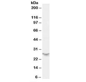 Western blot testing of human spleen lysate with PSME2 antibody at 0.5ug/ml. Predicted molecular weight: ~27kDa.~
