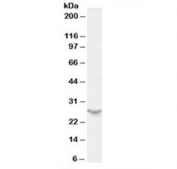 Western blot testing of human spleen lysate with PSME2 antibody at 0.5ug/ml. Predicted molecular weight: ~27 kDa.