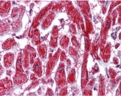IHC testing of FFPE human heart tissue with PDIp antibody at 3.75ug/ml. Required HIER: steamed antigen retrieval with pH6 citrate buffer; AP-staining.