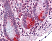 IHC testing of FFPE human small intestine tissue with PDIp antibody at 3.75ug/ml. Required HIER: steamed antigen retrieval with pH6 citrate buffer; AP-staining.