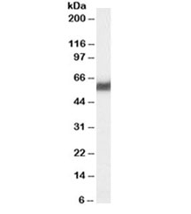 Western blot testing of human pancreas lysate with PDI antibody at 0.03ug/ml. Predicted molecular weight ~58/70kDa (unmodified/glycosylated).