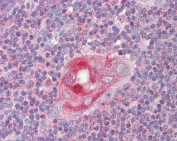 IHC testing of FFPE human thymus tissue with RGS1 antibody at 2.5ug/ml. Required HIER: steamed antigen retrieval with pH6 citrate buffer; AP-staining.