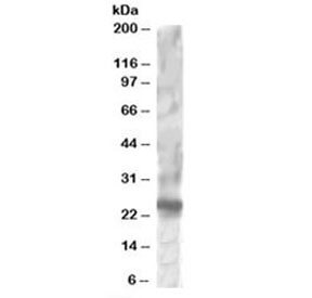 Western blot testing of HepG2 lysate with RGS1 antibody at 1ug/ml. Predicted molecular weight: ~24kDa.