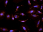IHC testing of PFA-fixed and TX100-treated HeLa cells with CYP26A1 antibody at 2.5ug/ml (DAPI nuclear counterstaining in blue).