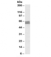 Western blot testing of human colorectal cancer lysate with CADM1 antibody at 1ug/ml. Predicted molecular weight: ~48/37kDa (isoforms 1/2) with N-linked and O-linked glycosylation each possibly adding ~25kDa to the observed size.