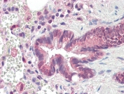 IHC testing of FFPE human lung tissue with PSMB3 antibody at 10ug/ml. Required HIER: steamed antigen retrieval with pH6 citrate buffer; AP-staining.