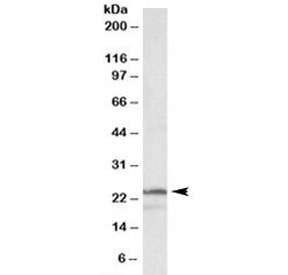 Western blot testing of K562 lysate with PSMB3 antibody at 1ug/ml. Predicted molecular weight: ~23kDa.~