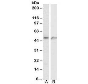 Western blot testing of human A) lung and B) umbical cord lysates with ECSM2 antibody at 1ug/ml. Predicted molecular weight: ~21/40-60kDa (unmodified/glycosylated).~