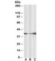 Western blot testing of human cerebellum [A], colon [B] and duodenum [C] lysate with LASP1 antibody at 1ug/ml. Predicted molecular weight: ~30/36kDa (isoforms 1/2).