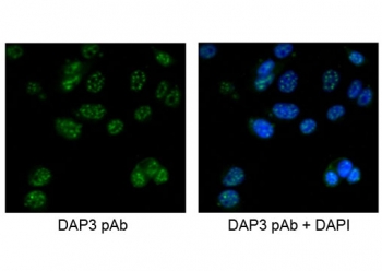 Immunofluorescent staining of human MCF7 cells with DAP3 antibody at 5ug/ml.