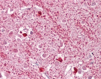 IHC testing of FFPE human brain cortex tissue with DAP3 antibody at 2.5ug/ml. Required HIER: steamed antigen retrieval with pH6 citrate buffer; AP-staining.