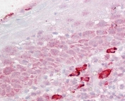 IHC testing of FFPE human tonsil tissue with DAP3 antibody at 2.5ug/ml. Required HIER: steamed antigen retrieval with pH6 citrate buffer; AP-staining.
